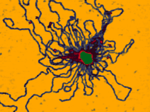 Adenovirus with DNA Bundle - True Non-Contact Mode