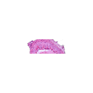 Banner-Achios-X_1